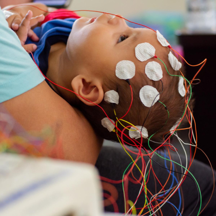 Paediatric Neurosurgery